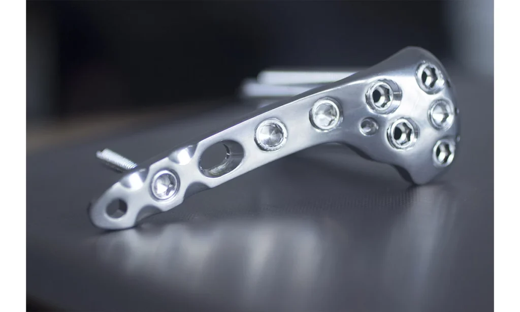 What type of Material is used in Orthopedic Implants